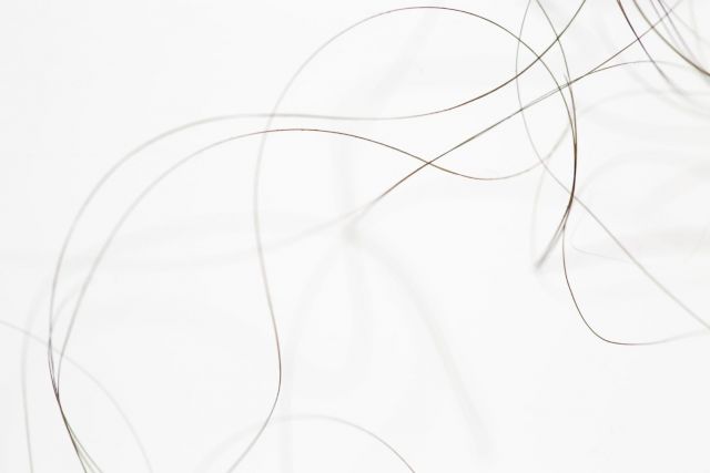 KARA SPRINGER, Ana and Andre I, 2014. © Courtesy the artist and Dr Kenneth Montague | The Wedge Collection